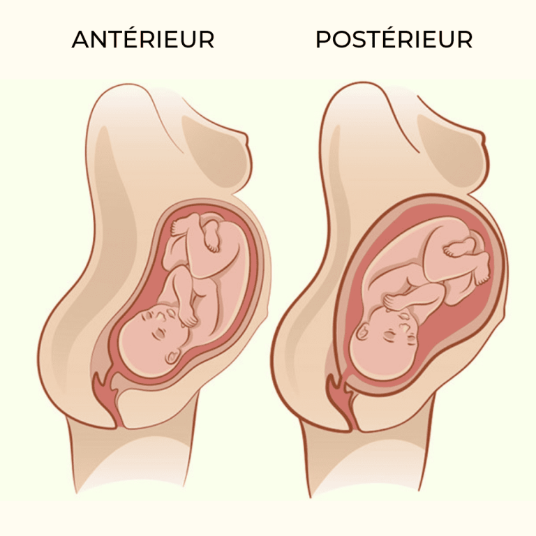 Améliorer la santé du col postérieur naturellement